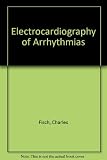 Electrocardiography of arrhythmias