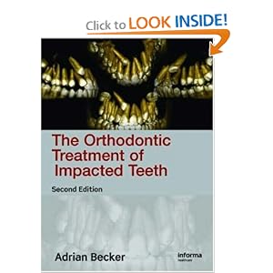 Click here to buy Orthodontic Treatment of Impacted Teeth by Adrian Becker.