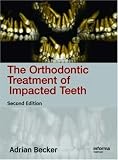 The Orthodontic Treatment of Impacted Teeth