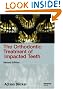 Orthodontic Treatment of Impacted Teeth