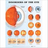 Disorders of the Eye Anatomical Chart