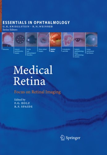 Medical Retina: Focus on Retinal Imaging (Essentials in Ophthalmology)