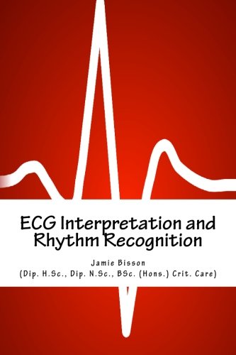 ecg interpretation and rhythm recognition