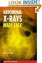 Abdominal X-Rays Made Easy