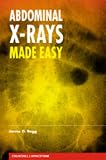 Abdominal X-Rays Made Easy