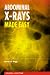 Abdominal X-Rays Made Easy