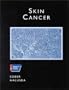 American Cancer Society Atlas of Clinical Oncology: Skin Cancer (Book with CD-ROM)