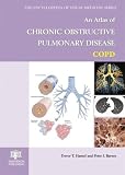 Atlas of Chronic Obstructive Pulmonary Disease