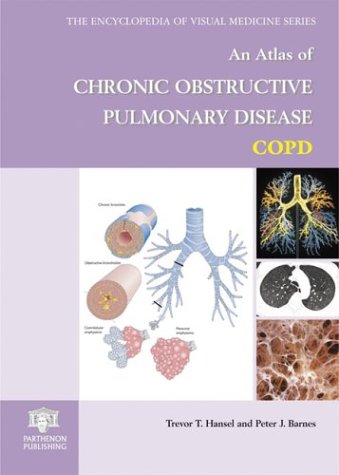 Atlas of Chronic Obstructive Pulmonary Disease (Encyclopedia of Visual Medicine Series)