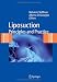 Liposuction: Principles and Practice