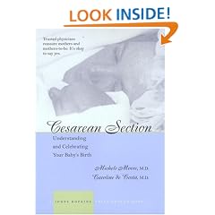 Cesarean Section: Understanding and Celebrating Your Baby's Birth