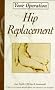 Hip Replacement (Your Operation)