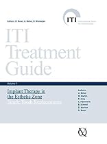 ITI Treatment Guide, Volume 1: Implant Therapy in the Esthetic Zone for Single-tooth Replacements (ITI Treatment Guides) ITI Treatment Guide, Volume 1: Implant Therapy in the Esthetic Zone for Single-tooth Replacements (ITI Treatment Guides)