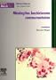 Meningites bacteriennes communautaires
