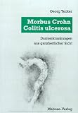 Morbus Crohn, Colitis Ulcerosa - Darmerkrankungen aus ganzheitlicher Sicht - Georg Tecker