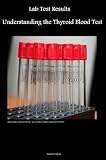 Lab Test Results - Understanding the Thyroid Blood Test