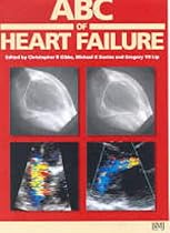 ABC of Heart Failure (ABC Series)