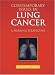 Contemporary Issues in Lung Cancer: A 2002 Nursing Perspective (Jones and Bartlett Series in Oncology) by  ISBN 0763719145
