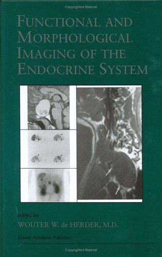 Endocrine-Diseases