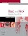 Search : Head and Neck Reconstruction with DVD: A Volume in the Procedures in Reconstructive Surgery Series
