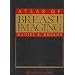 Atlas of Breast Imaging