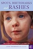 Spots, birthmarks and rashes : the complete guide to caring for your child's skin