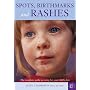 Spots, Birthmarks and Rashes: An Illustrated Guide to the Identification, Treatment and Possible Prevention of Childhood Skin Problems: The Complete Guide to Caring for Your Child's Skin