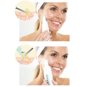 Rio Ultrasonic Facial Scraper Cleanser