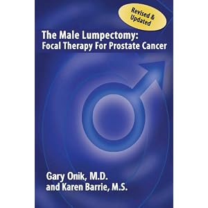 Male Lumpectomy Therapy Prostate Cancer 2