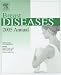 Books : Breast Diseases 2005 Annual
