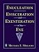 Enucleation, Evisceration, and Exenteration of the Eye, 1e
