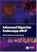 Advanced Digestive Endoscopy: ERCP