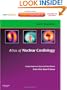 Atlas of Nuclear Cardiology: Imaging Companion to Braunwald's Heart Disease: Expert Consult - Online and Print, 1e (Imaging Techniques to Braunwald's Heart Disease)