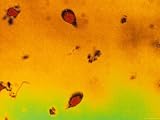 Giardia Lambia X1,000 Flagellate Protozoa Photographic Poster Print, 32x24