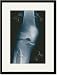 Black Framed/Matted Print 17x23, Knee