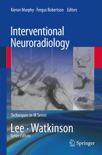 Interventional Neuroradiology (Techniques in Interventional Radiology)