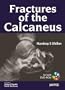 Fractures of the Calcaneus