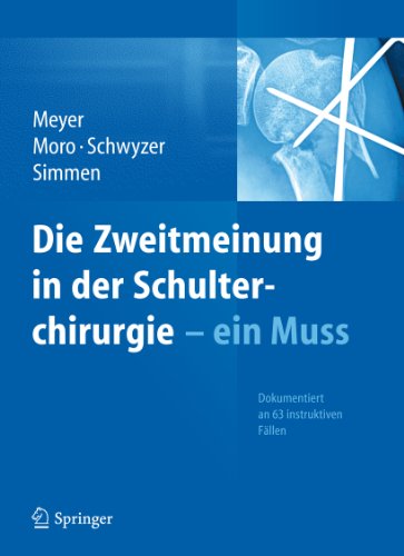 Die Zweitmeinung in der Schulterchirurgie - ein Muss (German Edition)