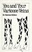 You and Your Varicose Veins (Overcoming Common Problems)