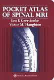 Pocket Atlas of Spinal MRI