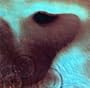 Meddle