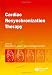 Cardiac Resynchronization Therapy