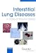 Book Interstitial Lung Diseases: A State-of-the-art Series (Thematic Review Series)