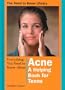 Everything You Need to Know About Acne: A Helping Book for Teens (Need to Know Library)