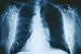 Art Poster, Chest - 27.5 x 18.75