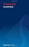 Handbook of osteoporosis