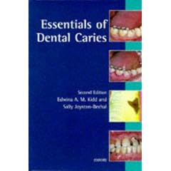 Essentials of Dental Caries: The Disease and Its Management (Oxford medical publications)