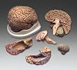 Budget Brain With Arteries Model