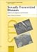 Book Sexually Transmitted Diseases: Advances in Diagnosis and Treatment (Current Problems in Dermatology)
