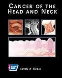 Cancer of the head and neck